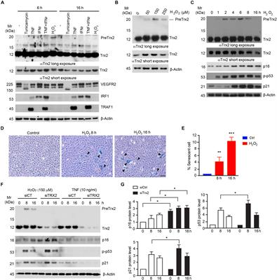 A Unique SUMO-Interacting Motif of Trx2 Is Critical for Its Mitochondrial Presequence Processing and Anti-oxidant Activity